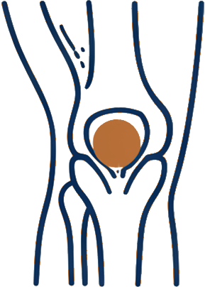 Line illustration of a knee joint