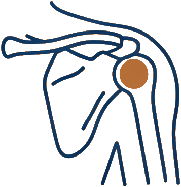 Line illustration of a shoulder joint