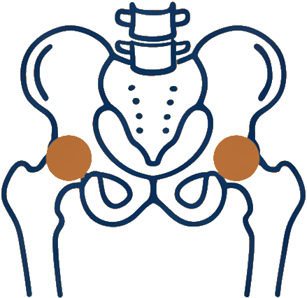 Line illustration of a hip joint