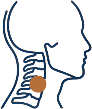 Line illustration of the neck and cervical spine