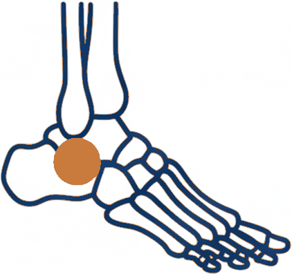 Line illustration of a foot and ankle