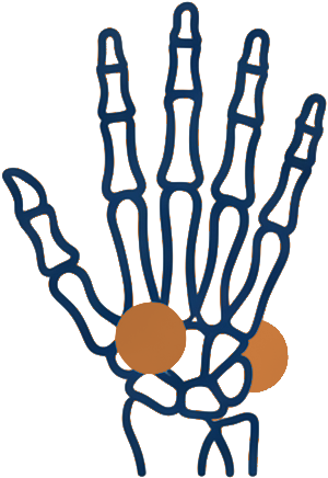 Line illustration of a hand and wrist